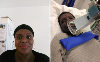 Brenda McKenzie before (left) and after she was diagnosed with a rare blood cancer