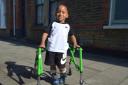Carter could walk with a life-changing operation. Picture: Polly Hancock
