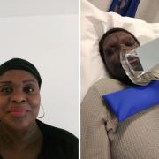 Brenda McKenzie before (left) and after she was diagnosed with a rare blood cancer